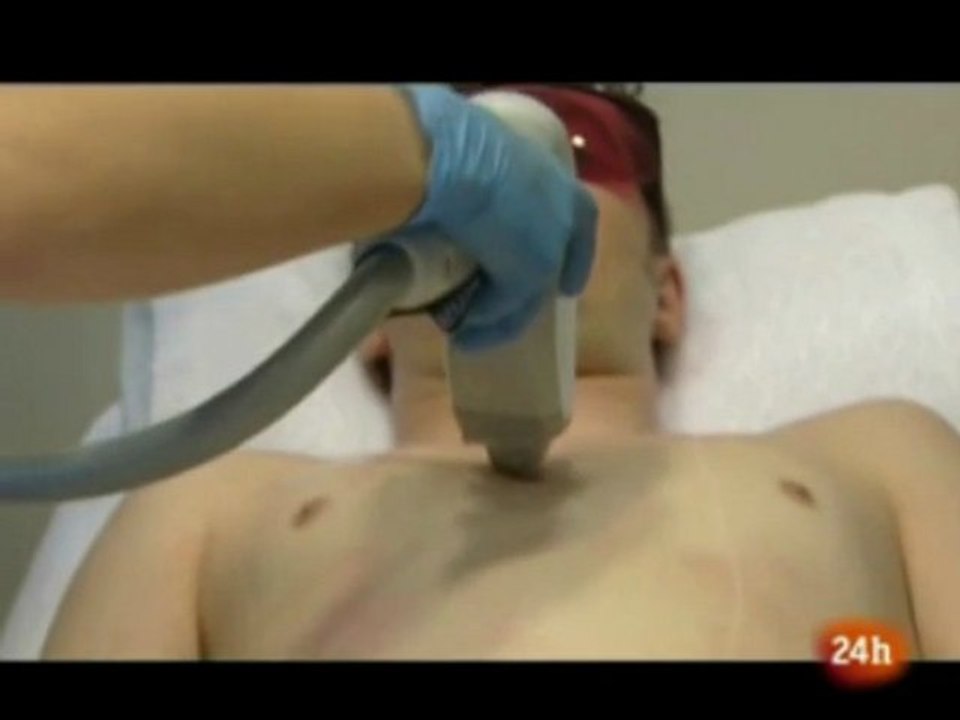 Tipos de Láser para tratamientos médico-estéticos en IML Madrid