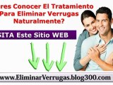 Quitar Verrugas De Las Manos - Eliminar Las Verrugas Genitales