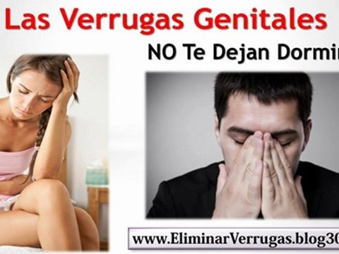 Verrugas Genitales Tratamiento Casero - Como Eliminar Verrugas Naturalmente