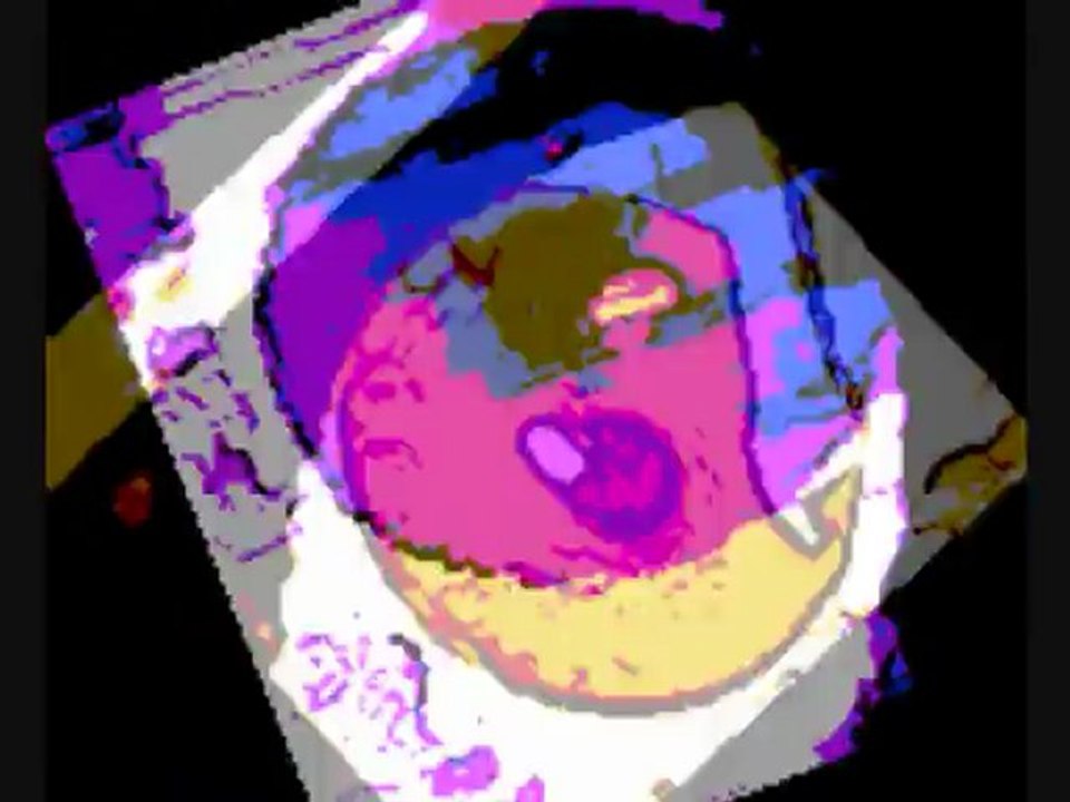 Double D09 olivinzedark korrigan69 labelambulance