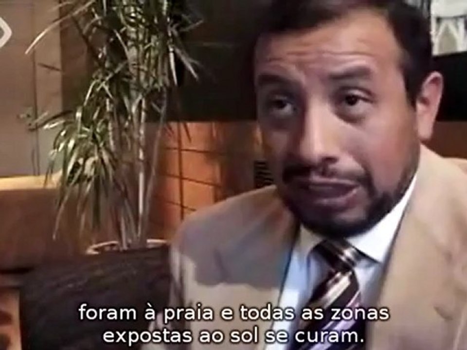 Variantes Clínicas de Micosis Fungoide [Subtitulado POR] - www.cedepap.tv