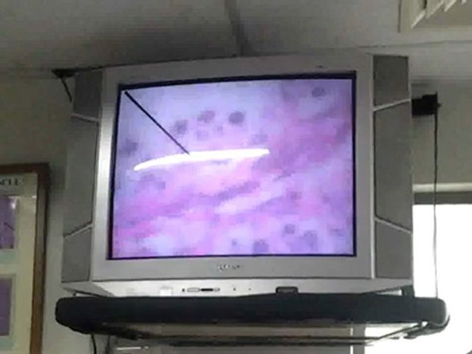 Testis(wmv)(wmv)