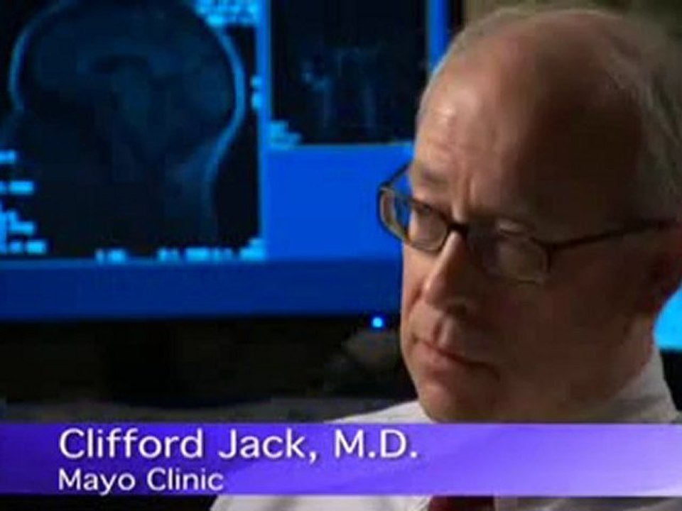 Imaging Dementia - Mayo Clinic