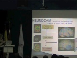 04.- 1ª Jornada EM (sfc). TECNICAS DE SPECT CEREBRAL. Dra García Quintana