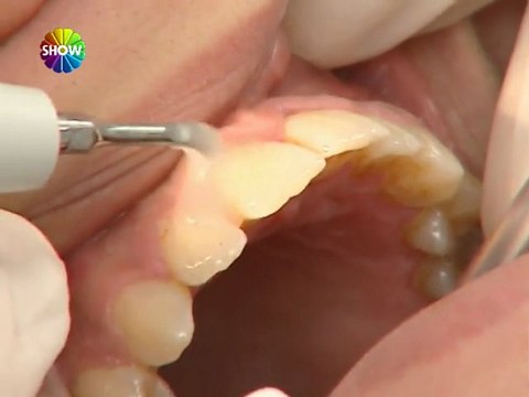 Emel Acar İle En Baştan - Duygu Ardal diş hekiminde