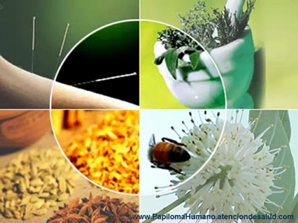 Condiloma Acuminado Tratamiento