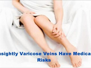 Unsightly Varicose Veins Have Medical Risks