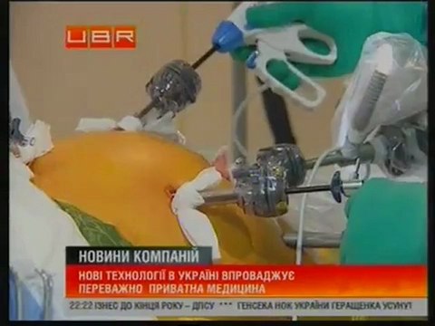 UBR- Мастер класс по лапароскопии в Лисод