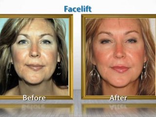Cosmetic Surgery La Jolla - Umansky Medical Center