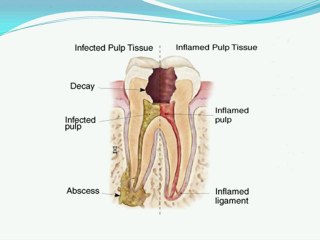 Dental implants san diego