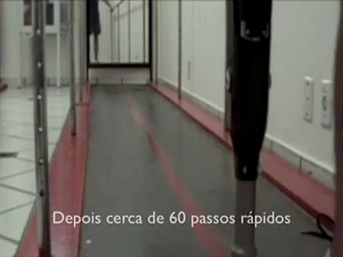 Protese MIE Marcel amputado - Endolite - Ortopedia Conforpés