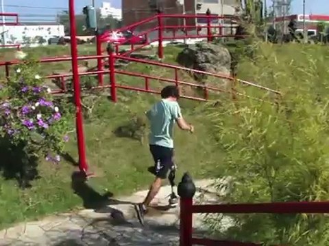 Protese da Alta Atividade do Talisson - Ortopedia Conforpés