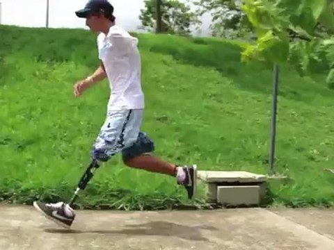 Talisson Correndo com Protese - Ortopedia Conforpés