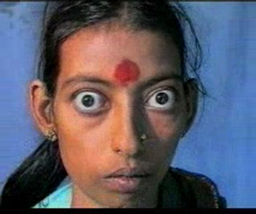 Examination of THYROID