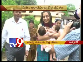 Conjoined twins Stuti, Aradhana seperated