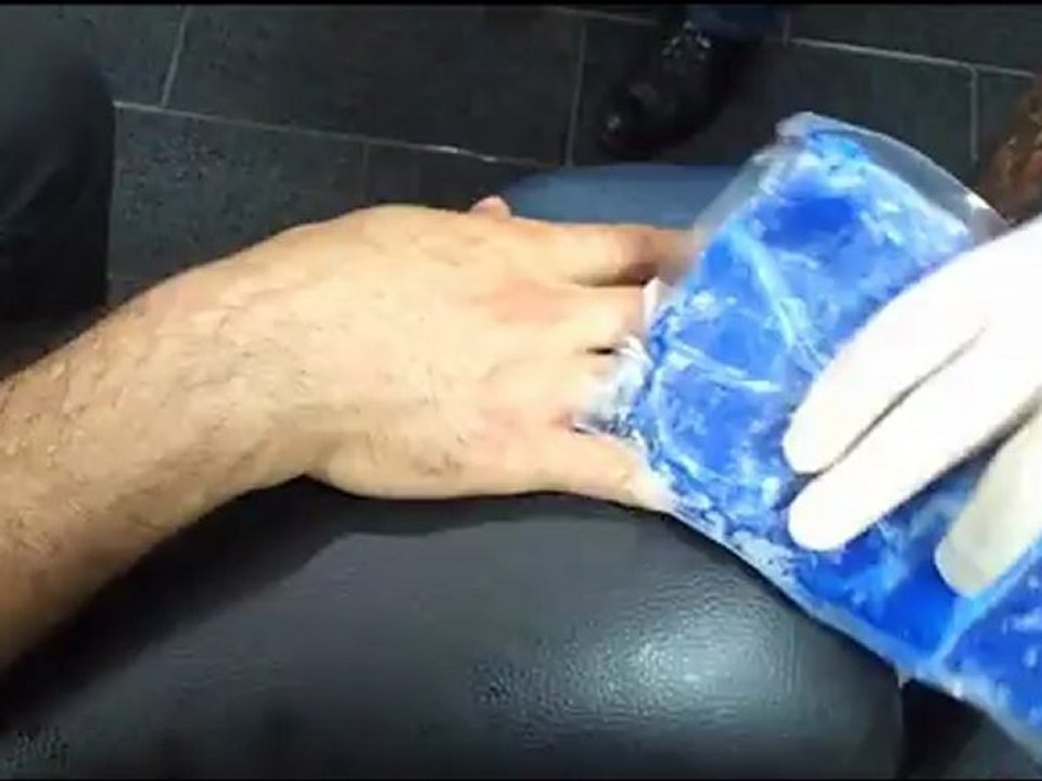 tattoomix dövme silme uygulaması