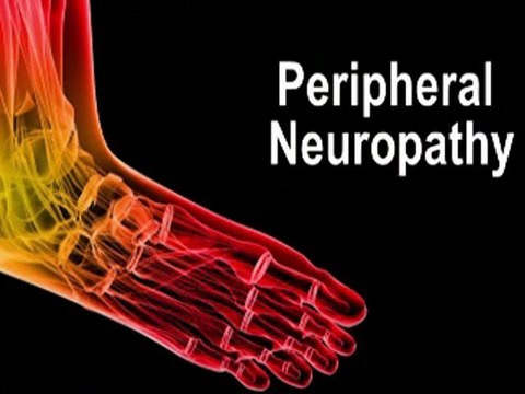 Peripheral Neuropathy - Podiatrist in Scottsdale and North Scottsdale AZ
