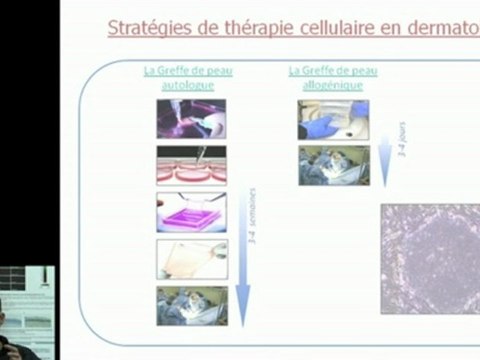 Cellules souches pluripotentes humaines et applications sur l'épiderme