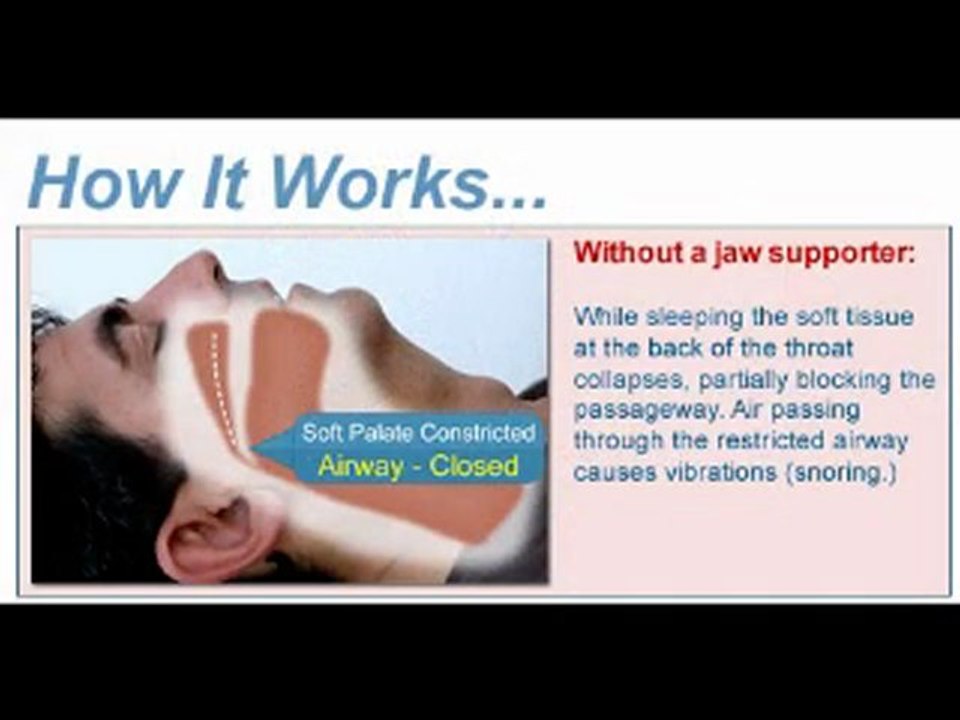 Anti-snoring review