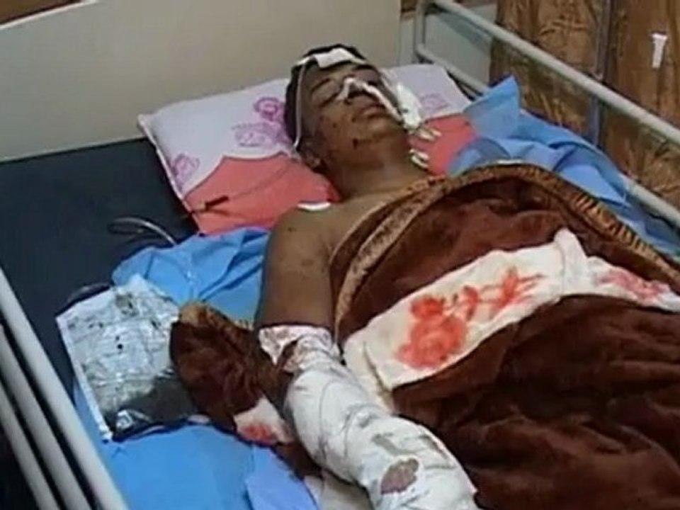 Iraq blast victims treated in hospital