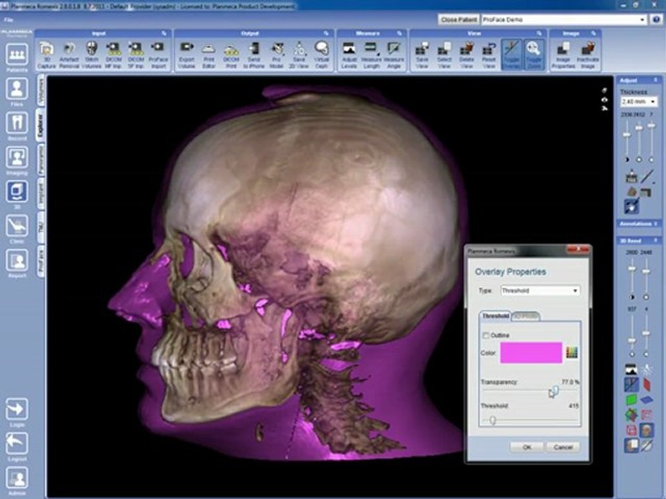 3D Vias Aereas