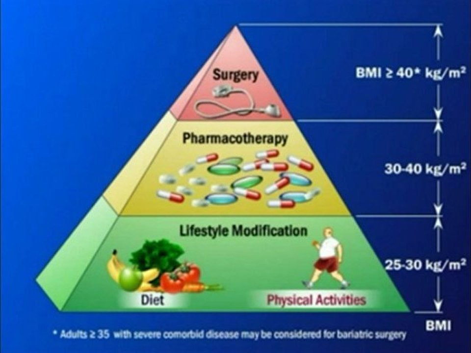 Weight loss Managing - How to Manage Your Obesity