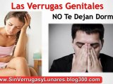 Como Quitar Verrugas De La Cara - Como Quitar Verrugas En El Cuello