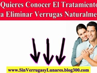 Extraccion De Lunares - Extraccion De Lunares - Como Remover Verrugas