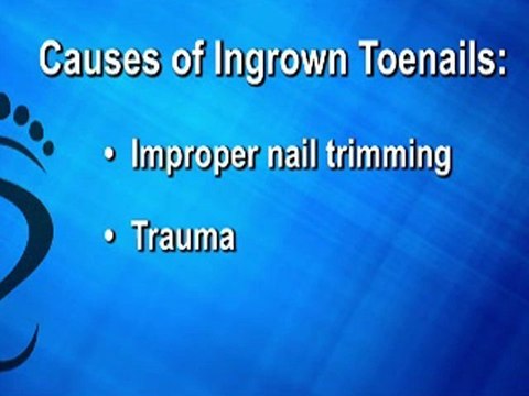 Ingrown Toenails - Podiatrist Warren, Springfield and Edison, NJ -