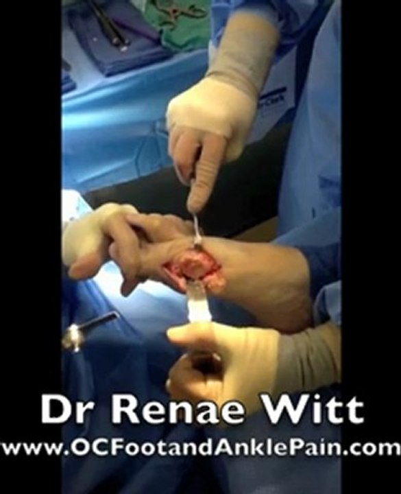 Foot and Ankle Specialist 714-439-3400 Tustin CA