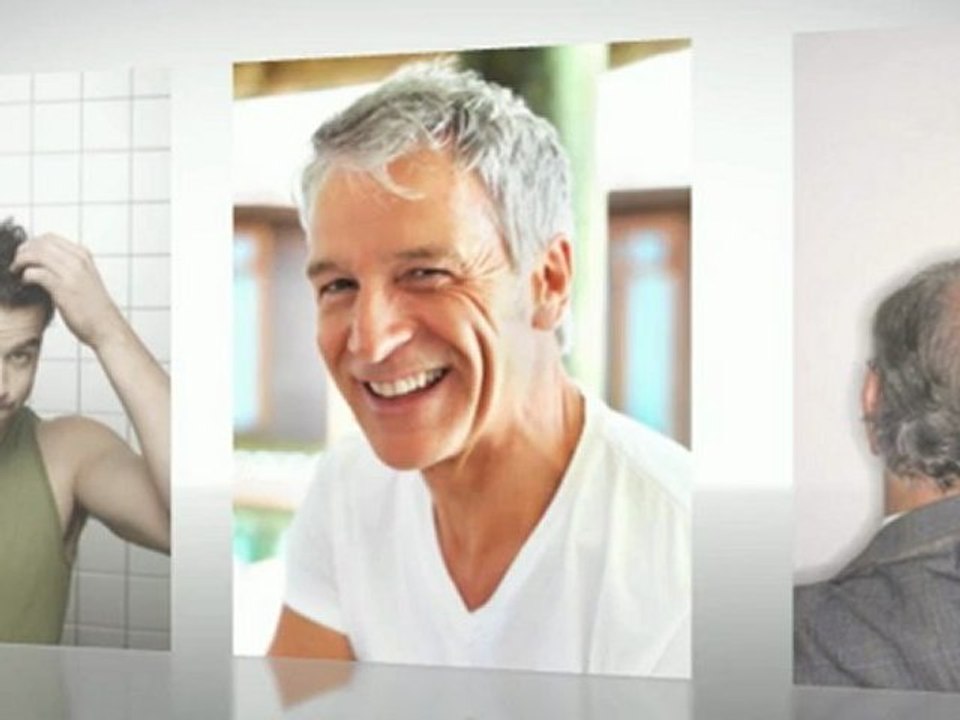 Hair Implants For More Confidence