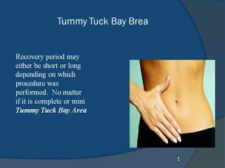 Tummy Tuck San Francisco