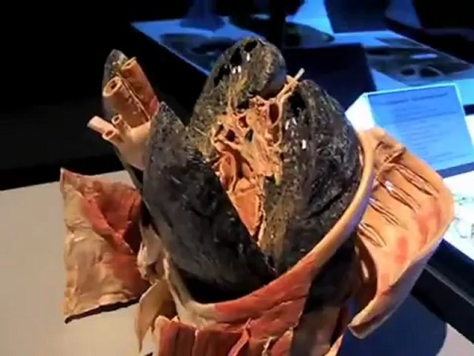 Körperwelten - eine Herzenssache. Ausstellung Augsburg 6.6.-13.09.2009