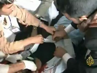 إرتفاع عدد قتلى والجرحى اليمنيين المعتصمين