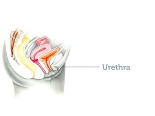 Vaginal Mesh Complications