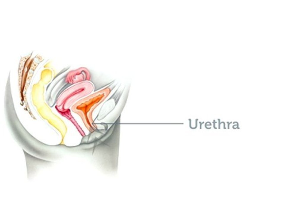 Vaginal Mesh Complications
