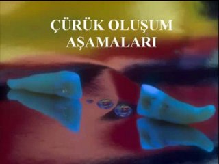 (diş evi) diş nasıl çürür?