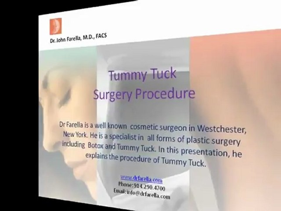 Tummy Tuck - Abdominoplasty