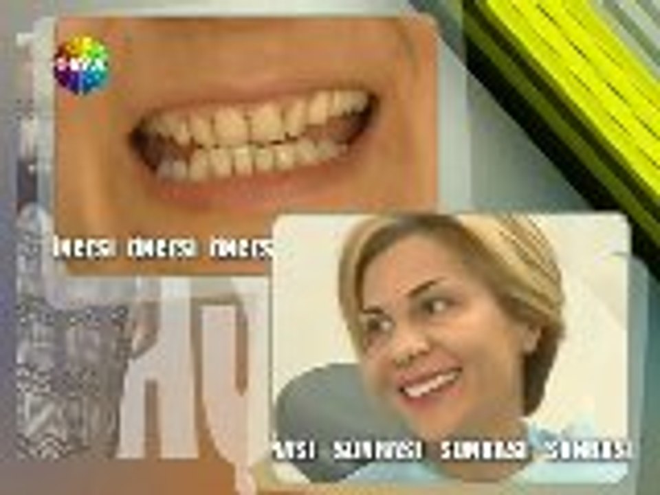 Emel Acar İLe En Baştan - Beyhan Demirer diş hekiminde part 2