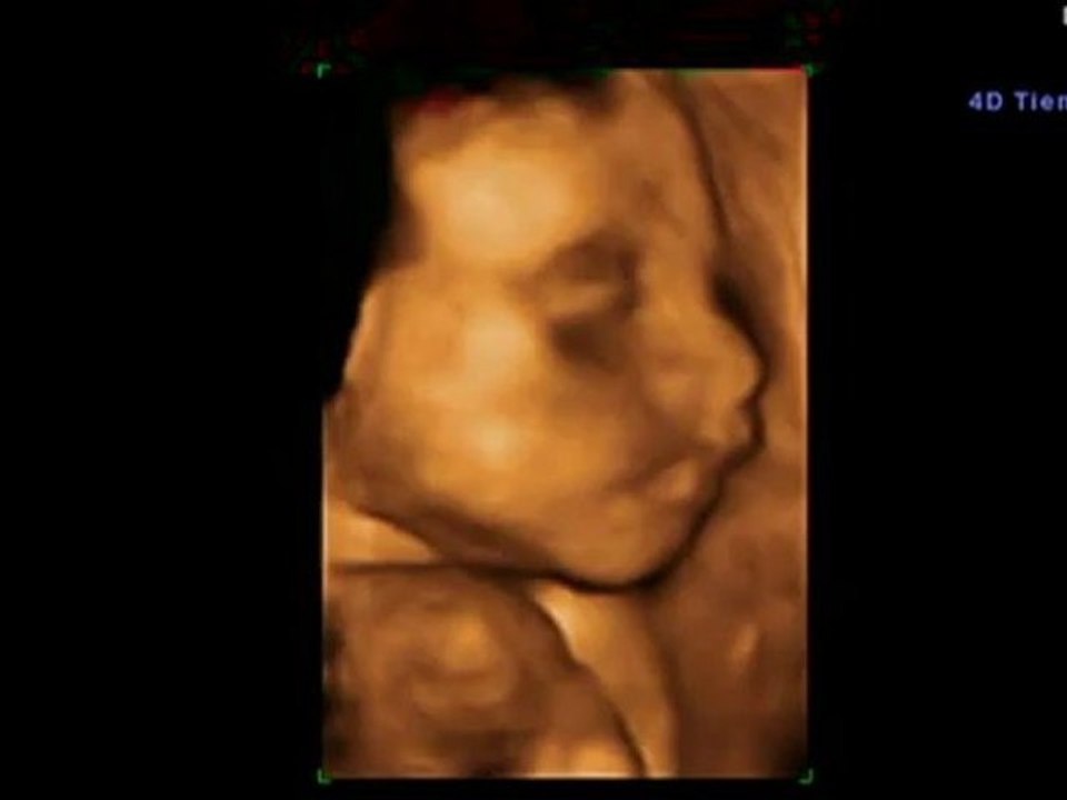 27 Semanas