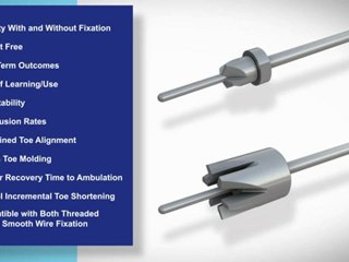 Final Animation FuseRight Hammer Toe Fusion Reamer