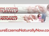 Amazing  All Natural Remedies For Eczema - Natural ...