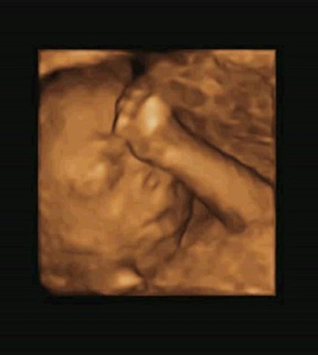 foetus