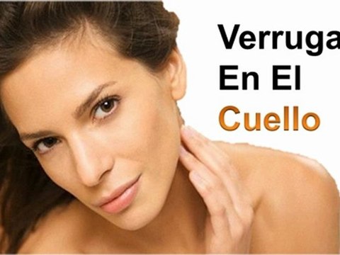 Como Eliminar Una Verruga - Verrugas En Los Senos