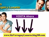 Como Quitar Mis Lunares - Como Eliminar Mis Verrugas