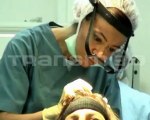 Hair Transplantation With Fue Method by Transmed Clinic
