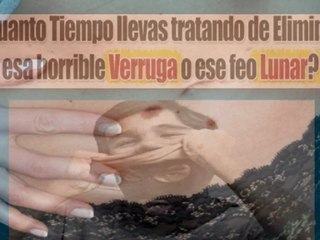 Se Pueden Quitar Los Lunares