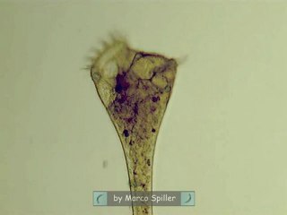 Stentor: trumpet animalcule