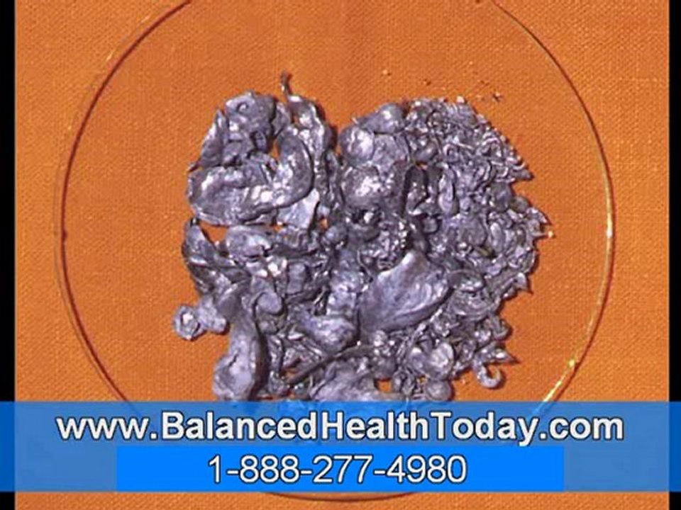 BPH Treatment Benign Prostatic Hypertrophy Options Part 2