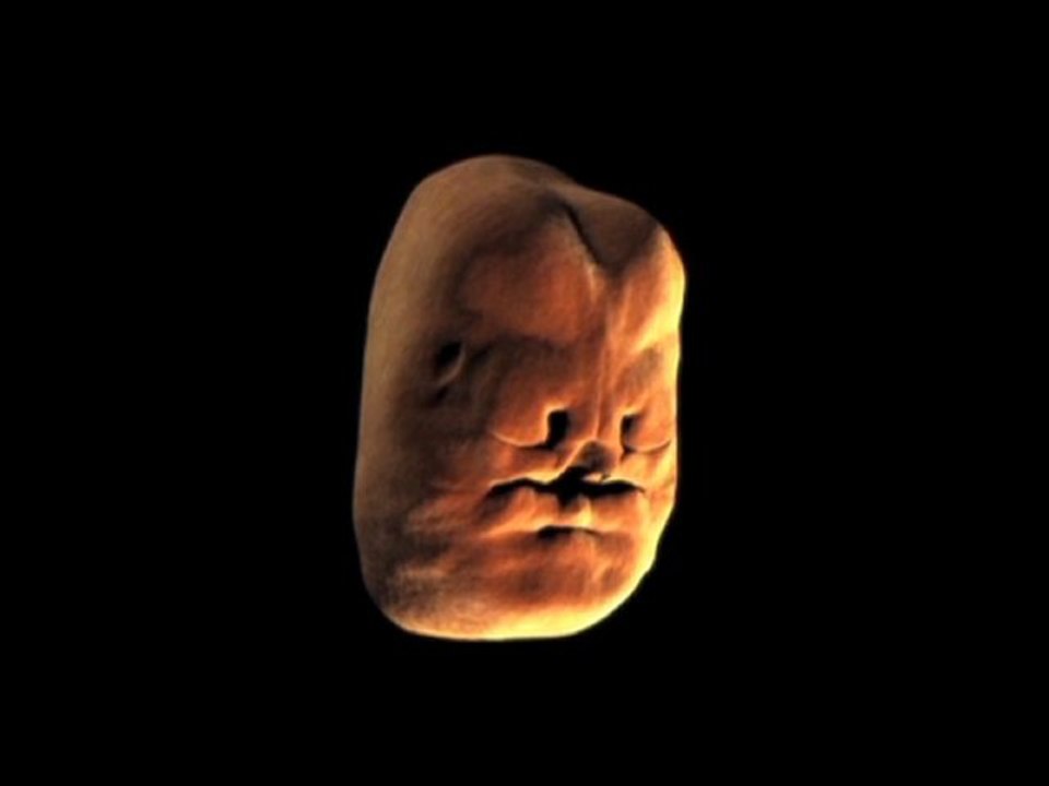 Comment se forme le visage d'un foetus dans le ventre de sa mère